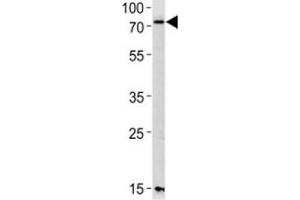 Western blot analysis of lysate from mouse NIH3T3 cell line using PAK3 antibody diluted at 1:1000 for each lane.