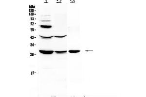 Western blot analysis of TL1A using anti-TL1A antibody . (TNFSF15 anticorps  (AA 72-244))