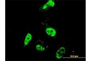 Immunofluorescence of monoclonal antibody to PML on HeLa cell. (PML anticorps  (AA 411-510))