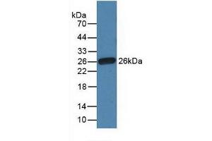 Detection of Recombinant Fibronectin, Gallus using Polyclonal Antibody to Fibronectin (FN)