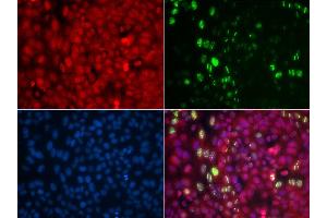 Immunofluorescence analysis of U2OS cells using Phospho-ABL1-Y204 antibody (ABIN5969866). (ABL1 anticorps  (pTyr204))