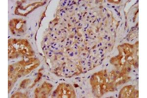 IHC image of ABIN7143836 diluted at 1:400 and staining in paraffin-embedded human kidney tissue performed on a Leica BondTM system.