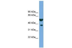 WB Suggested Anti-APEX1 Antibody Titration: 0. (APEX1 anticorps  (N-Term))