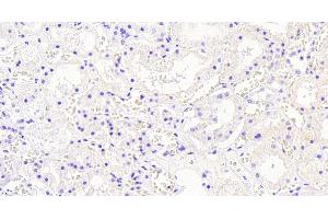 ABIN184795 Negative Control showing staining of paraffin embedded Human Kidney, with no primary antibody.
