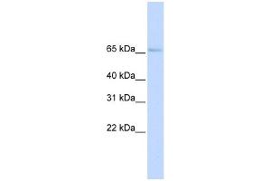 SLC22A6 antibody used at 1 ug/ml to detect target protein. (SLC22A6 anticorps)