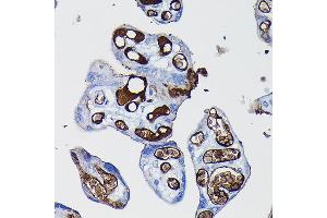 Immunohistochemistry of paraffin-embedded human placenta using Fibrinogen alpha chain (Fibrinogen alpha chain (FGA)) Rabbit pAb (ABIN7267178) at dilution of 1:100 (40x lens).