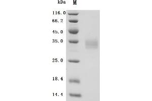 Galectin 3 (LGALS3) (AA 1-250), (full length) protein (His tag)