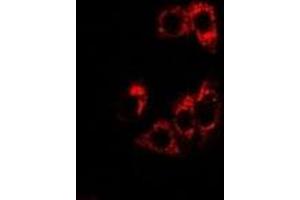 Immunofluorescent analysis of SHP staining in U2OS cells. (NR0B2 anticorps)