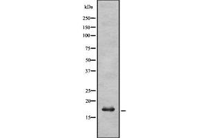 Western blot analysis UBE2L6 using K562 whole cell lysates