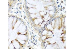 Immunohistochemistry of paraffin-embedded Human colon using PI3 Polyclonal Antibody at dilution of 1:100 (40x lens).