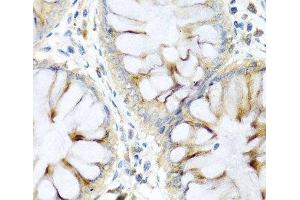 Immunohistochemistry of paraffin-embedded Human colon using PI3 Polyclonal Antibody at dilution of 1:100 (40x lens). (PI3 anticorps)