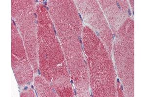 IHC-P Image Immunohistochemical analysis of paraffin-embedded human skeletal muscle, using DNA polymerase gamma, antibody(10 μg/ml).