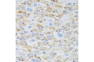 Immunohistochemistry of paraffin-embedded mouse liver using TIRAP antibody. (TIRAP anticorps  (AA 1-221))