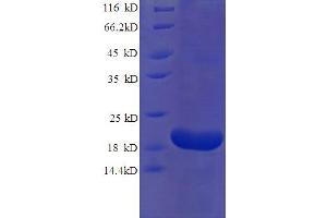 SDS-PAGE (SDS) image for Ribonuclease, RNase A Family, 2 (Liver, Eosinophil-Derived Neurotoxin) (RNASE2) (AA 28-161) protein (His tag) (ABIN5710262)