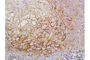 Formalin-fixed and paraffin embedded mouse intestine labeled with Anti CD44v5 Polyclonal Antibody, Unconjugated (ABIN680623) at 1:200 followed by conjugation to the secondary antibody and DAB staining (CD44RC (AA 61-139) anticorps)