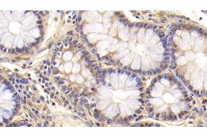 Detection of CD3e in Human Colon Tissue using Polyclonal Antibody to T-Cell Surface Glycoprotein CD3 Epsilon (CD3e) (CD3 epsilon anticorps  (AA 28-185))