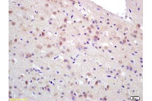 Formalin-fixed and paraffin embedded rat brain labeled with Rabbit Anti CCDC12 Polyclonal Antibody, Unconjugated (ABIN872486) at 1:200 followed by conjugation to the secondary antibody and DAB staining (CCDC12 anticorps  (AA 19-120))