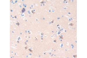 Used in DAB staining on fromalin fixed paraffin- embedded Kidney tissue (CA8 anticorps  (AA 1-290))