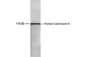 Western blot analysis of recombinant human Calcineurin A protein using 0. (Calcineurin A anticorps  (AA 450-500))