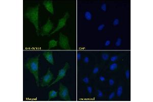 ABIN184715 Immunofluorescence analysis of paraformaldehyde fixed HeLa cells, permeabilized with 0.