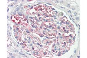 anti-C4b-Binding Protein antibody