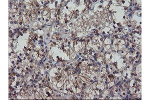 Image no. 1 for anti-Prefoldin Subunit 3 (PFDN3) antibody (ABIN1501705)