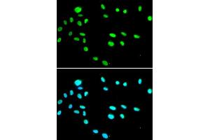 Immunofluorescence analysis of A549 cells using RUVBL1 antibody. (RUVBL1 anticorps)