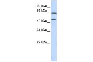 Western Blotting (WB) image for anti-Chondroitin Sulfate N-Acetylgalactosaminyltransferase 1 (CSGALNACT1) antibody (ABIN2459114) (CSGALNACT1 anticorps)
