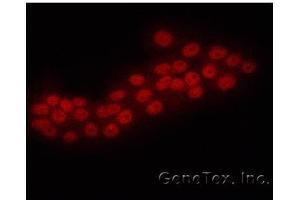 ICC/IF Image Immunofluorescence analysis of human pancreatic cancer cell line, using ERG, antibody at 1:50 dilution.