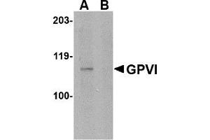 Western Blotting (WB) image for anti-Glycoprotein VI (Platelet) (GP6) (Middle Region) antibody (ABIN1030943) (GP6 anticorps  (Middle Region))