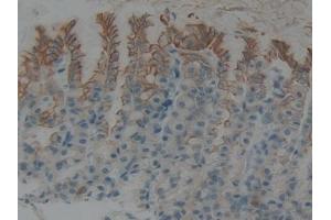 Detection of CK5 in Rat Stomach Tissue using Polyclonal Antibody to Cytokeratin 5 (CK5)