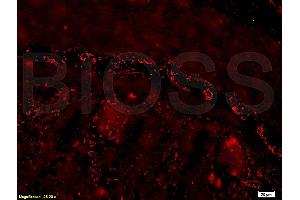 Formalin-fixed and paraffin embedded mouse small intestine tissue labeled with Rabbit Anti-PACAP-38 Polyclonal Antibody (ABIN726215), Unconjugated at 1:200 followed by conjugation to the secondary antibody and DAB staining.