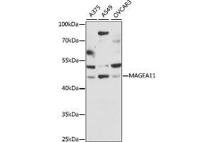 Western blot analysis of extracts of various cell lines, using M antibody (ABIN7268455) at 1:1000 dilution. (MAGEA11 anticorps  (AA 1-110))