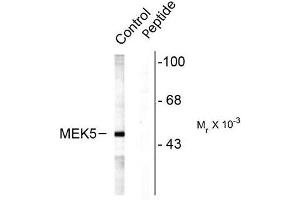 Image no. 1 for anti-Mitogen-Activated Protein Kinase Kinase 5 (MAP2K5) (pSer311), (pThr315) antibody (ABIN372667) (MAP2K5 anticorps  (pSer311, pThr315))