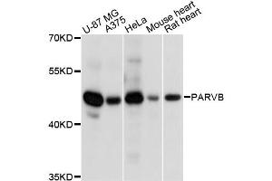 Western blot analysis of extracts of various cell lines, using PARVB antibody. (Parvin, beta anticorps)