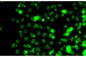 Immunofluorescence analysis of HeLa cells using SECISBP2 Polyclonal Antibody (SECISBP2 anticorps)