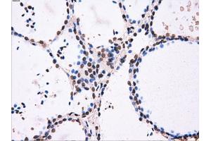 Image no. 3 for anti-ATP Synthase, H+ Transporting, Mitochondrial F1 Complex, beta Polypeptide (ATP5B) antibody (ABIN1496766)