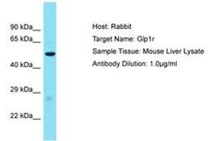 Image no. 1 for anti-Glucagon-Like Peptide 1 Receptor (GLP1R) (AA 101-150) antibody (ABIN6750508) (GLP1R anticorps  (AA 101-150))