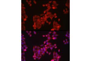Immunofluorescence analysis of HeLa cells using ZIP14 Rabbit pAb (ABIN6133191, ABIN6147993, ABIN6147994 and ABIN6214658) at dilution of 1:100 (40x lens). (SLC39A14 anticorps  (AA 240-340))
