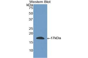 Western blot analysis of the recombinant protein. (CD40 Ligand anticorps  (AA 180-261))