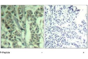 Image no. 2 for anti-Cas-Br-M (Murine) Ecotropic Retroviral Transforming Sequence (CBL) (pTyr700) antibody (ABIN319294) (CBL anticorps  (pTyr700))