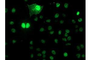 Image no. 2 for anti-N-Acyl Phosphatidylethanolamine phospholipase D (NAPEPLD) antibody (ABIN1499643)