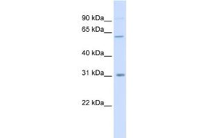 WB Suggested Anti-CHST2 Antibody Titration:  0. (CHST2 anticorps  (Middle Region))