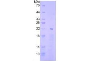 SDS-PAGE of Protein Standard from the Kit  (Highly purified E.