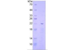SDS-PAGE of Protein Standard from the Kit  (Highly purified E. (EGR1 Kit ELISA)