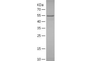 Western Blotting (WB) image for Myosin Binding Protein C, Slow Type (MYBPC1) (AA 1-300) protein (His-IF2DI Tag) (ABIN7124056) (MYBPC1 Protein (AA 1-300) (His-IF2DI Tag))