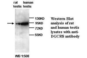 Image no. 1 for anti-DiGeorge Syndrome Critical Region Gene 8 (DGCR8) antibody (ABIN790956) (DGCR8 anticorps)