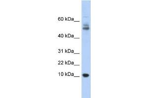WB Suggested Anti-MTPN Antibody Titration: 0. (MTPN anticorps  (Middle Region))