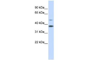 WB Suggested Anti-C2orf25 Antibody Titration: 0. (MMADHC anticorps  (Middle Region))