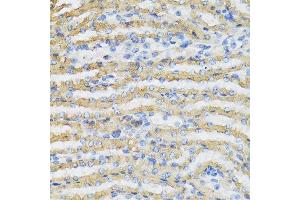 Immunohistochemistry of paraffin-embedded mouse kidney using C4BPB antibody at dilution of 1:100 (40x lens). (C4BPB anticorps)
